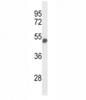 Western blot analysis of FOXG1 antibody and mouse brain tissue lysate. Predicted molecular weight: 50-52 kDa.