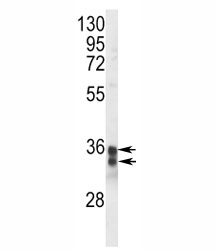 Western blot analysis of STING antibody and Jurkat lysate. Observed molecular weight: 33, 35 kDa.