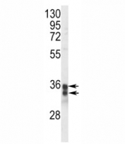 Western blot analysis of STING antibody and Jurkat lysate. Predicted molecular weight ~42/35 kDa, observed here at 33/35 kDa.