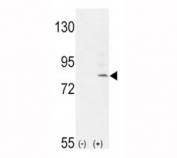 Western blot analysis of FGFR1 antibody and 293 cell lysate (2 ug/lane) either nontransfected (Lane 1) or transiently transfected with the FGFR1 gene (2). Predicted molecular weight: 75-160 kDa depending on glycosylation level.