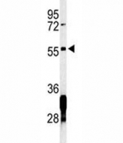 Western blot analysis of RNF8 antibody and Jurkat lysate. Predicted molecular weight ~56 kDa but may be observed at larger sizes due to ubiquitination.