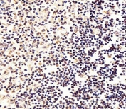 IHC analysis of FFPE human thymus section using FOXP1 antibody; Ab was diluted at 1:25.