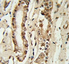 FOXP1 antibody IHC analysis in formalin fixed and paraffin embedded lung tissue.