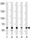 FOXP1 antibody western blot analysis in (1) A549, (2) Daudi, (3) Jurkat, (4) MCF-7, and (5) NCI-H292 lysate