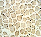 PGP antibody IHC analysis in formalin fixed and paraffin embedded skeletal muscle.
