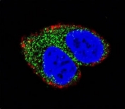 Confocal immunofluorescent analysis of AIM2 antibody with MCF-7 cells followed by Alexa Fluor 488-conjugated goat anti-rabbit lgG (green). Actin filaments have been labeled with Alexa Fluor 555 Phalloidin (red). DAPI was used as a nuclear counterstain (blue).