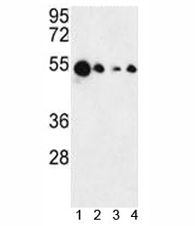 Western blot analysis of AIM2 antibody and 1) MCF-7, 2) HL-60, 3) K562 and 4) HeLa lysate. Predicted molecular weight 40-45 kDa.