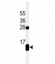 Western blot analysis of PLB / Phospholamban antibody and Jurkat lysate. Predicted molecular weight: 6/12/18/24kDa (monomer/dimer/oligomers).