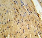 Phospholamban antibody IHC analysis in formalin fixed and paraffin embedded mouse heart tissue.