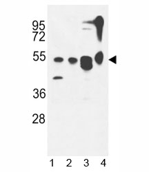 ATG13 antibody western blot analysis in 1) MDA-MB435,2) CEM, 3) T47D cell line and 4) mouse cerebellum tissue lysate. Predicted molecular weight ~55 kDa.~