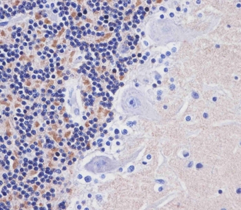 IHC staining of FFPE human cerebellum with AMH antibody. HIER: boil tissue sections in pH6, 10mM citrate buffer, for 20 min and allow to cool before testing.