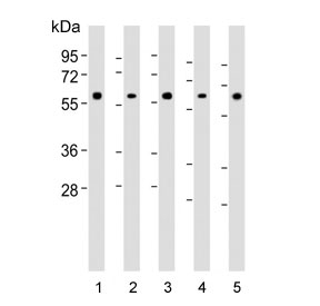 Western blot testing of human 1) cerebellum, 2) HeLa, 3) HepG2, 4) SH-SY5Y and 5) U-87 MG lysate with AMH antibody. Predicted molecular weight ~60 kDa. Glycosylated homodimer seen ~ 140 kDa.