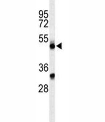 Western blot analysis of CFP antibody and CEM lysate.~