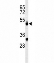 Western blot analysis of CFP antibody and CEM lysate.