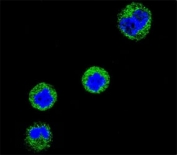 Confocal immunofluorescent analysis of CD1e antibody with MDA-MB435 cells followed by Alexa Fluor 488-conjugated goat anti-rabbit lgG (green). DAPI was used as a nuclear counterstain (blue).