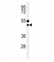 CD1e antibody western blot analysis in MDA-MB435 lysate