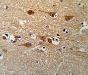 SMAD3 antibody IHC analysis in formalin fixed and paraffin embedded brain tissue.