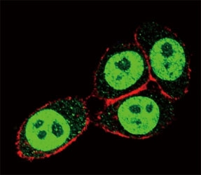 Confocal immunofluorescent analysis of SMAD3 antibody with HeLa cells followed by Alexa Fluor 488-conjugated goat anti-rabbit lgG (green). Actin filaments have been labeled with Alexa Fluor 555 Phalloidin (red).