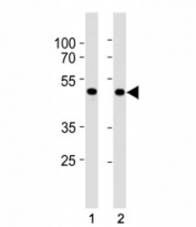 SMAD3 antibody western blot analysis in HepG2 and mouse C2C12 lysate. Observed molecular weight: 48~55 kDa.