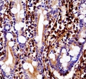 Vimentin antibody immunohistochemistry analysis in formalin fixed and paraffin embedded human small intestine tissue