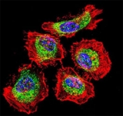 Confocal immunofluorescent analysis of Vimentin antibody with HeLa cells followed by Alexa Fluor 488-conjugated goat anti-rabbit lgG (green). Actin filaments have been labeled with Alexa Fluor 555 Phalloidin (red). DAPI was used as a nuclear counterstain (blue).