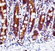 Src antibody immunohistochemistry analysis in formalin fixed and paraffin embedded human small intestine tissue