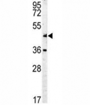 c-Myc antibody western blot analysis in mouse Neuro-2a lysate. Theoretical molecular weight: ~50 kDa but routinely observed at 50~70 kDa.