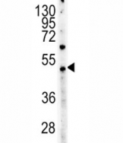 c-Myc antibody western blot analysis in HeLa lysate. Theoretical molecular weight: ~50 kDa but routinely observed at 50~70 kDa.
