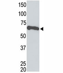 Tagged recombinant protein tested with the c-Myc antibody.