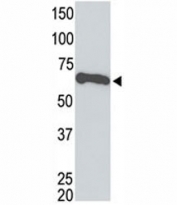 Tagged recombinant protein tested with the c-Myc antibody.