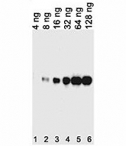 Tagged recombinant protein tested with anti-His antibody.