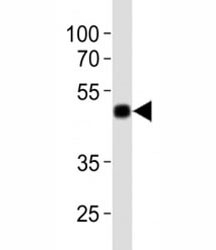 Western blot analysis of lysate from 12 tag recombinant protein using anti-His antibody at 1:1000.~