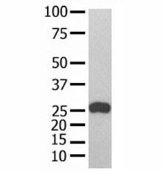 GST Tag antibody used in western blot with recombinant protein~