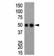 Western blot analysis of HA antibody and tagged recombinant protein bacterial lysate