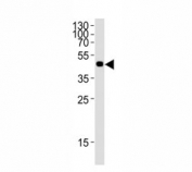 Western blot analysis of lysate from a 41 kDa 12 tagged protein using FLAG antibody at 1:1000.