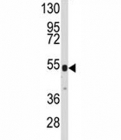 Western blot analysis of V5 Tag antibody and 12 tagged protein lysate.