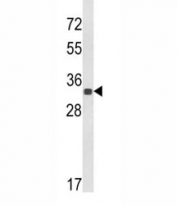 Western blot analysis of His Tag antibody and a His tagged protein.