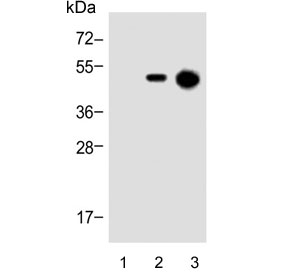 Western blot testing of 1) 293T/17 cell lysate, 2) 12-tag transfected 293T/17 cell lysate and 3) 12-tag recombinant protein with His Tag antibody.~