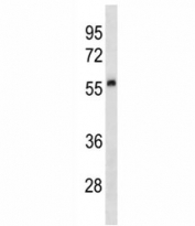 Urokinase antibody western blot analysis in human placenta tissue lysate