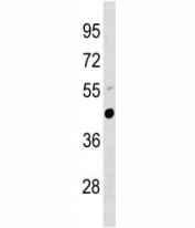 Urokinase antibody western blot analysis in mouse lung tissue lysate.