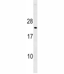 p27Kip1 antibody western blot analysis in mouse heart tissue lysate