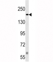 TSC2 antibody western blot analysis in Jurkat lysate