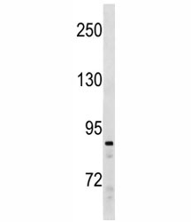 SUZ12 antibody western blot analysis in Ramos lysate. Observed molecular weight 83~95 kDa.