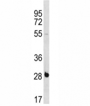 RBPMS antibody western blot analysis in NCI-H460 lysate.