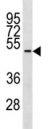 TUBD1 antibody western blot analysis in ZR-75-1 lysate.