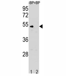 Western blot analysis of Cyclin B antibody pre-incubated without (Lane 1) and with (2) blocking peptide in K562 lysate. Predicted molecular weight: 48-60 kDa