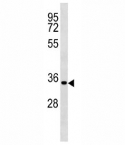 Cyclin D2 antibody western blot analysis in MDA-MB231 lysate. Predicted molecular weight ~33 kDa.