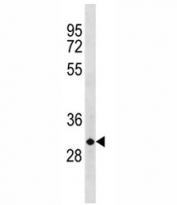 CCND3 antibody western blot analysis in human MDA-MB-231 lysate. Predicted molecular weight ~33 kDa.