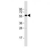 TGFBR1 antibody western blot analysis in mouse kidney tissue lysate. Predicted molecular weight: ~55 kDa.