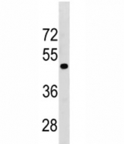TGFBR1 antibody western blot analysis in mouse Neuro-2a lysate. Predicted molecular weight: ~55 kDa.